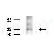 AKAP14 Antibody - Western blot analysis of extracts from Rat liver, using AKAP14 Antibody at 1/1000 dilution.