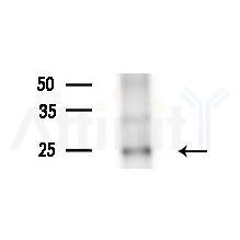 AKAP14 Antibody - Western blot analysis of extracts from HepG2 cells(UV treatment), using AKAP14 Antibody at 1/1000 dilution.