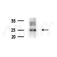 AKAP14 Antibody - Western blot analysis of extracts from B16F10-LUC cells(starvation treatment), using AKAP14 Antibody at 1/1000 dilution.