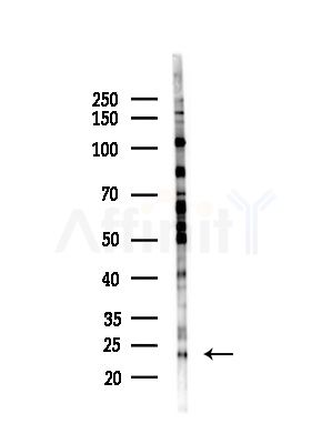 AKAP14 Antibody - Western blot analysis of lysates from B16F10-LUC cells(starvation,24h treatment), using AKAP14 Antibody at 1/1000 dilution.