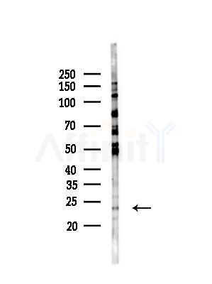 AKAP14 Antibody - Western blot analysis of lysates from HepG2 cells(UV,30min treatment), using AKAP14 Antibody at 1/1000 dilution.