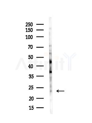 AKAP14 Antibody - Western blot analysis of lysates from Rat liver, using AKAP14 Antibody at 1/1000 dilution.