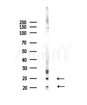 TUSC5 Antibody - Western blot analysis of lysates from Hela cells(starvation,24h treatment), using TUSC5 Antibody at 1/1000 dilution.