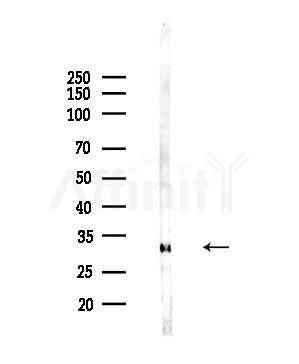 SPIC Antibody - Western blot analysis of lysates from Hela cells(starvation,24h treatment), using SPIC Antibody at 1/1000 dilution.