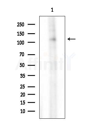 RGAG1 Antibody - Western blot analysis of extracts from 3T3-L1 cells(LPS  4h treatment), using RGAG1 Antibody at 1/1000 dilution.