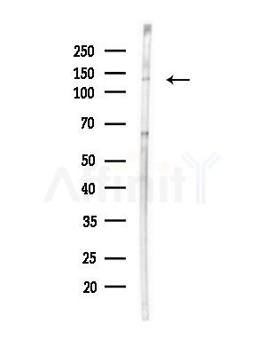 RGAG1 Antibody - Western blot analysis of lysates from Hela cells(LPS,4h treatment), using RGAG1 Antibody at 1/1000 dilution.