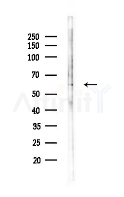 PPHLN Antibody - Western blot analysis of lysates from Hela cells(heat-shock,45min treatment), using PPHLN Antibody at 1/1000 dilution.