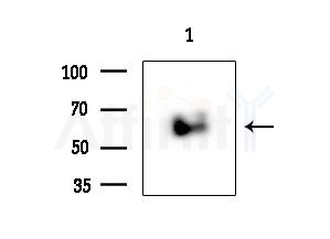 ZNF397 Antibody - Western blot analysis of extracts from Rat testis, using ZNF397 Antibody at 1/1000 dilution.