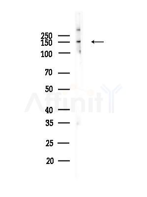 BAF250B Antibody - Western blot analysis of lysates from COLO205 cells, using BAF250B Antibody at 1/1000 dilution.