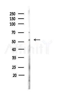 ADCK3 Antibody - Western blot analysis of lysates from MDA-MB-231 cells(heat-shock,45min treatment), using ADCK3 Antibody at 1/1000 dilution.