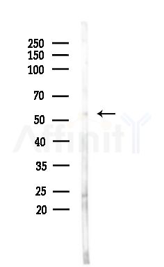 ADCK3 Antibody - Western blot analysis of lysates from Mouse brain, using ADCK3 Antibody at 1/1000 dilution.