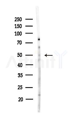 ADCK3 Antibody - Western blot analysis of lysates from Hela cells(heat-shock,45min treatment), using ADCK3 Antibody at 1/1000 dilution.