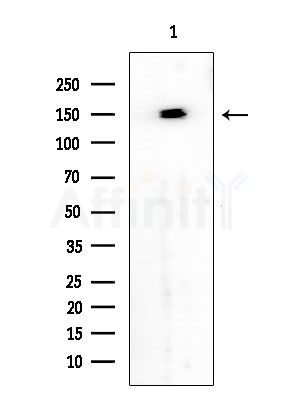 SMRC2 Antibody - Western blot analysis of extracts from HUVEC cells, using SMRC2 Antibody at 1/1000 dilution.