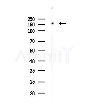 SMRC2 Antibody - Western blot analysis of lysates from HUVEC cells, using SMRC2 Antibody at 1/1000 dilution.