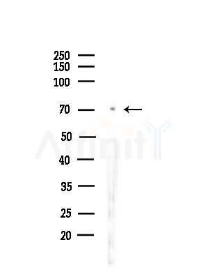 ES8L1 Antibody - Western blot analysis of lysates from PC12 cells(starvation,24h treatment), using ES8L1 Antibody at 1/1000 dilution.