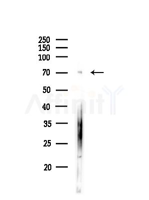 ES8L1 Antibody - Western blot analysis of lysates from COLO205 cells(heat-shock,45min treatment), using ES8L1 Antibody at 1/1000 dilution.