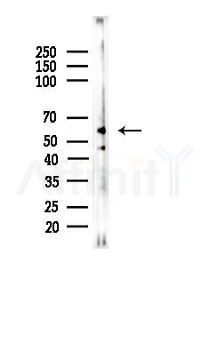 GRK7 Antibody - Western blot analysis of lysates from B16F10-LUC cells(UV,30min treatment), using GRK7 Antibody at 1/1000 dilution.