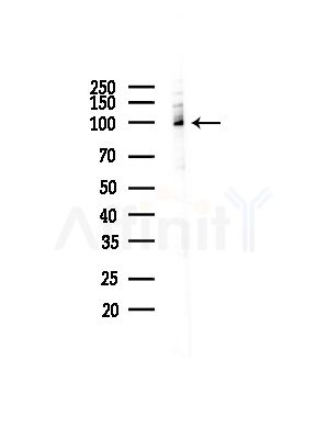GTF3C2 Antibody - Western blot analysis of lysates from COLO205 cells(UV,30min treatment), using GTF3C2 Antibody at 1/1000 dilution.