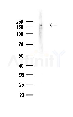 MADD Antibody - Western blot analysis of lysates from Hela cells(heat-shock,45min treatment), using MADD Antibody at 1/1000 dilution.