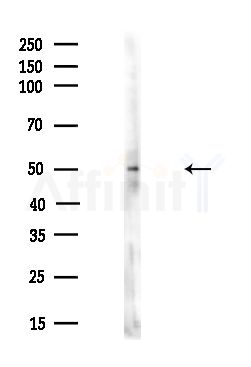 CDKL2 Antibody - Western blot analysis of lysates from A375 cells(heat-shock,45min treatment), using CDKL2 Antibody at 1/1000 dilution.