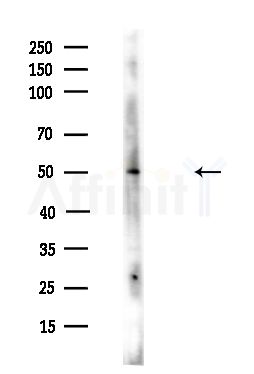 CDKL2 Antibody - Western blot analysis of lysates from HUVEC cells(UV,30min treatment), using CDKL2 Antibody at 1/1000 dilution.