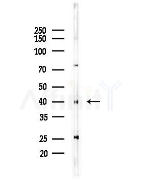 REQU Antibody - Western blot analysis of lysates from LoVo cells(heat-shock,45min treatment), using REQU Antibody at 1/1000 dilution.