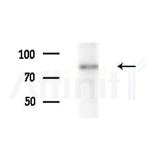 EZH1 Antibody - Western blot analysis of extracts from MDA-MB-231 cells(heat-shock,45min treatment), using EZH1 Antibody at 1/1000 dilution.