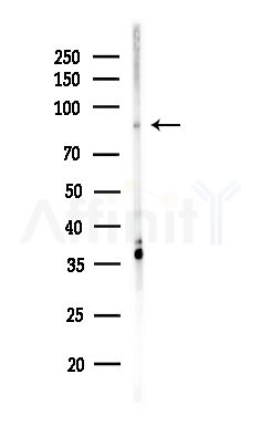 EZH1 Antibody - Western blot analysis of lysates from MDA-MB-231 cells(heat-shock,45min treatment), using EZH1 Antibody at 1/1000 dilution.