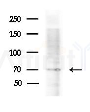 TAF15 Antibody - Western blot analysis of lysates from various samples, using TAF15 Antibody at 1/1000 dilution.