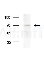 TAF15 Antibody - Western blot analysis of lysates from Rat lung, using TAF15 Antibody at 1/1000 dilution.