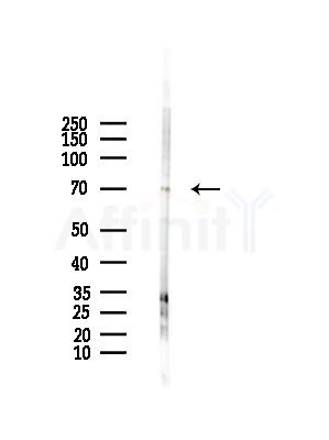 TAF15 Antibody - Western blot analysis of lysates from HepG2 cells(LPS,4h treatment), using TAF15 Antibody at 1/1000 dilution.