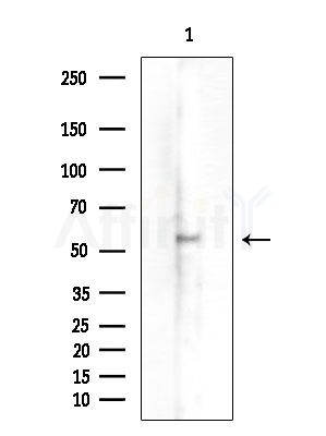 CELF-1 Antibody - Western blot analysis of extracts from B16F10-LUC cells(UV 30min treatment), using CELF-1 Antibody at 1/1000 dilution.