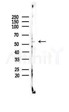 CELF-1 Antibody - Western blot analysis of lysates from B16F10-LUC cells(UV,30min treatment), using CELF-1 Antibody at 1/1000 dilution.