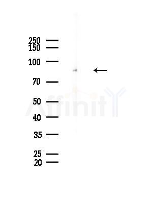 HPK1 Antibody - Western blot analysis of lysates from HUVEC cells(starvation,24h treatment), using HPK1 Antibody at 1/1000 dilution.