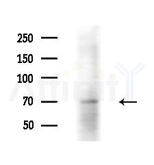 BRF1 Antibody - Western blot analysis of extracts from A375 cells(starvation,24h treatment), using BRF1 Antibody at 1/1000 dilution.