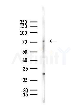 BRF1 Antibody - Western blot analysis of lysates from A375 cells(starvation,24h treatment), using BRF1 Antibody at 1/1000 dilution.