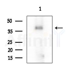 PMEPA1 Antibody - Western blot analysis of extracts from COLO205 cells, using PMEPA1 Antibody at 1/1000 dilution.