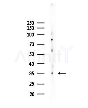 PMEPA1 Antibody - Western blot analysis of lysates from COLO205 cells, using PMEPA1 Antibody at 1/1000 dilution.