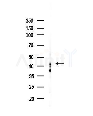 ORCTL-2 Antibody - Western blot analysis of lysates from MCF7 cells(heat-shock,45min treatment), using ORCTL-2 Antibody at 1/1000 dilution.