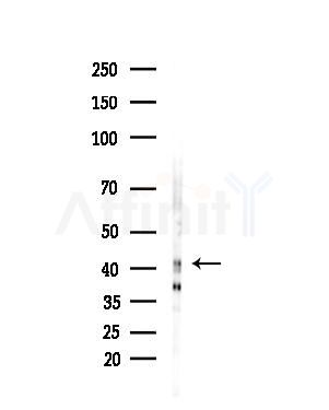 ORCTL-2 Antibody - Western blot analysis of lysates from Hela cells(heat-shock,45min treatment), using ORCTL-2 Antibody at 1/1000 dilution.