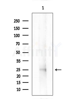 MOBKL2A/B Antibody - Western blot analysis of extracts from Mouse liver, using MOBKL2A/B Antibody at 1/1000 dilution.
