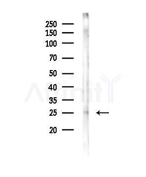 MOBKL2A/B Antibody - Western blot analysis of lysates from Mouse liver, using MOBKL2A/B Antibody at 1/1000 dilution.