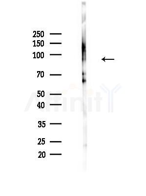 PGBD1 Antibody - Western blot analysis of lysates from LoVo cells(heat-shock,45min treatment), using PGBD1 Antibody at 1/1000 dilution.