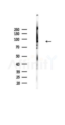 PGBD1 Antibody - Western blot analysis of lysates from HUVEC cells(UV,30min treatment), using PGBD1 Antibody at 1/1000 dilution.