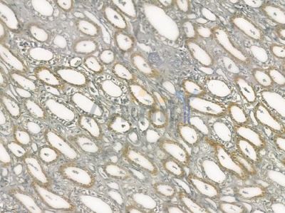 PGBD1 Antibody - DF3399 at 1/100 staining human normal kidney tissue by IHC-P.
