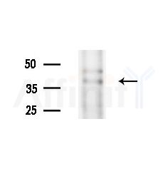 FAM84B Antibody - Western blot analysis of extracts from HepG2 cells(UV treatment), using FAM84B Antibody at 1/1000 dilution.