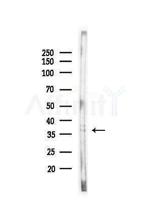FAM84B Antibody - Western blot analysis of lysates from HepG2 cells(UV,30min treatment), using FAM84B Antibody at 1/1000 dilution.