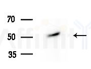 IP6K3 Antibody - Western blot analysis of extracts from Mouse liver, using IP6K3 Antibody at 1/1000 dilution.