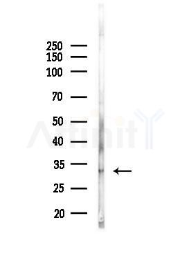 CIB3 Antibody - Western blot analysis of lysates from Rat liver, using CIB3 Antibody at 1/1000 dilution.
