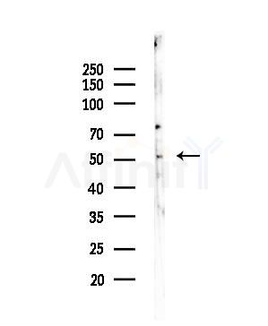 TINF2 Antibody - Western blot analysis of lysates from HUVEC cells, using TINF2 Antibody at 1/1000 dilution.